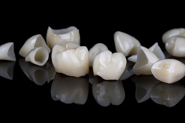What Are the Differences Between a Dental Crown and a Dental Veneer? from Brilliant Smiles Lakeland in Lakeland, FL
