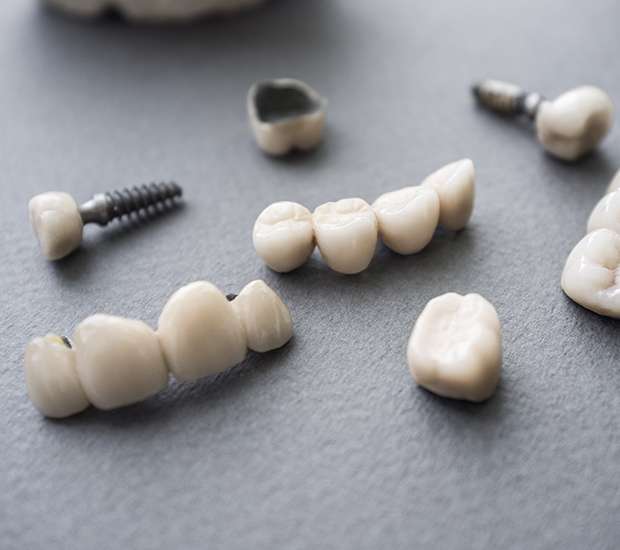 Lakeland The Difference Between Dental Implants and Mini Dental Implants